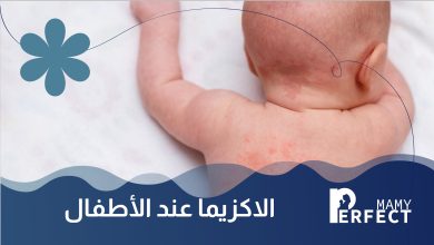 الاكزيما عند الاطفال