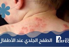 طفح جلدي عند الاطفال