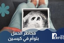 مخاطر الحمل بتوأم في كيسين