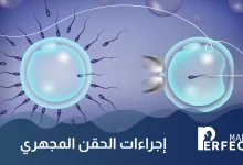 كيف تتم عملية الحقن المجهري بالتفصيل
