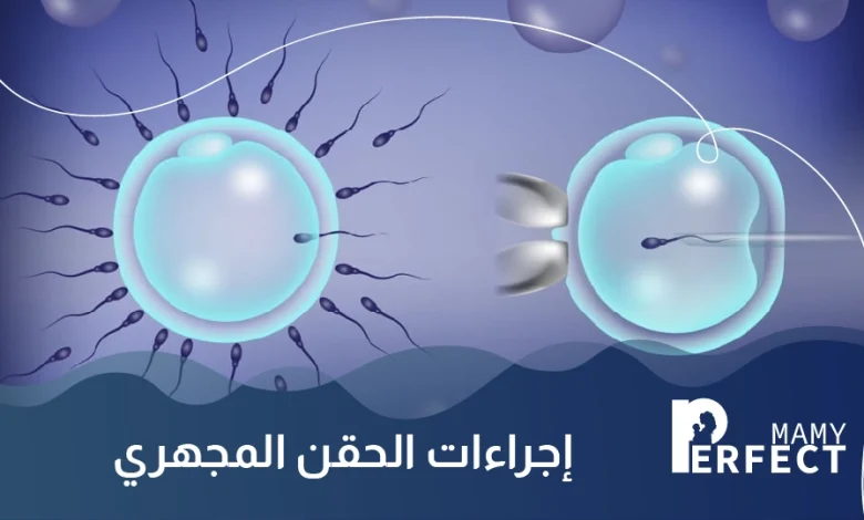 كيف تتم عملية الحقن المجهري بالتفصيل