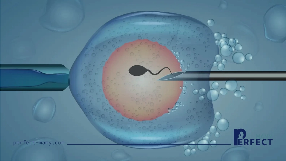 تعريف الحقن المجهري