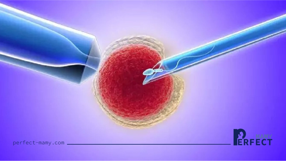 التحضير لعملية الحقن المجهري
