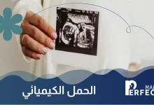 الحمل الكيميائي