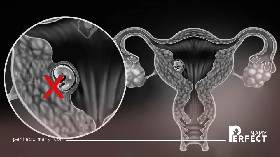 كيف يتم الكشف عن الحمل الكيميائي؟