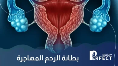 بطانة الرحم المهاجرة