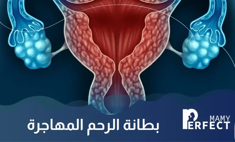 بطانة الرحم المهاجرة