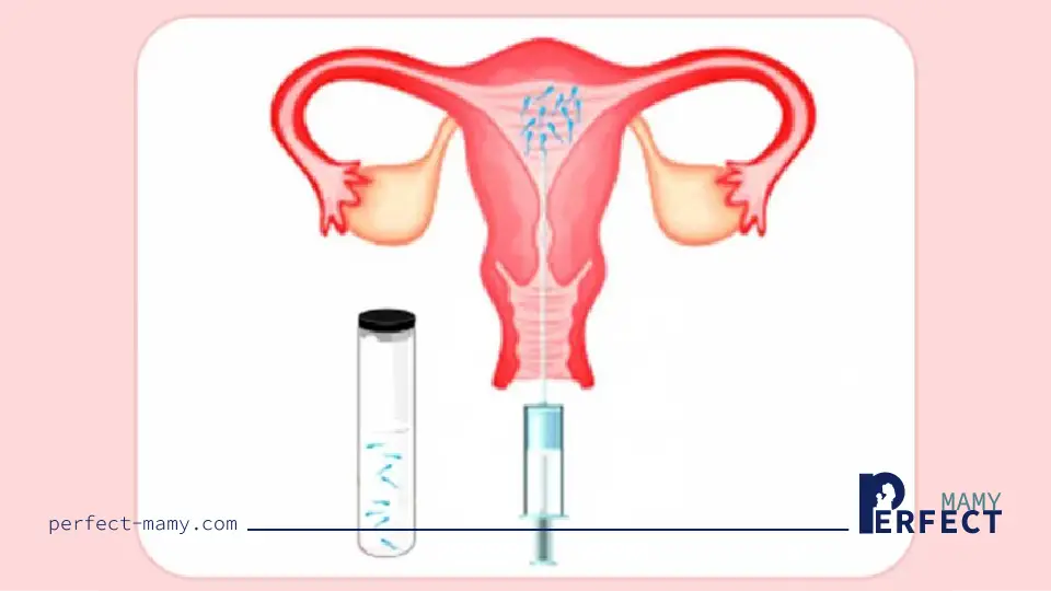 كيفة علاج بطانة الرحم المهاجرة 