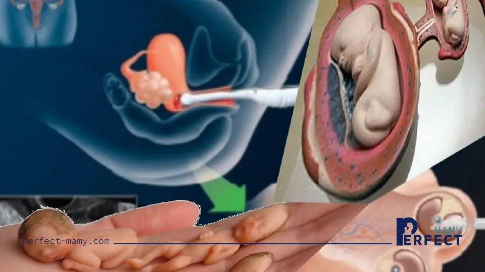 تكلفة الحقن المجهري