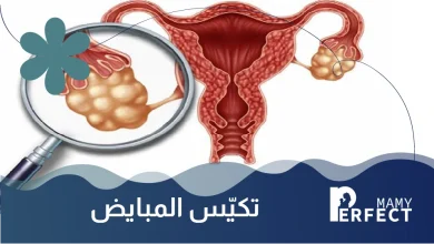 تكييس المبايض