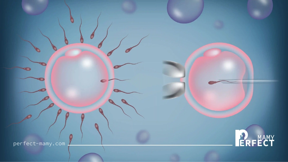 الحقن المجهري وعوامل نجاحها